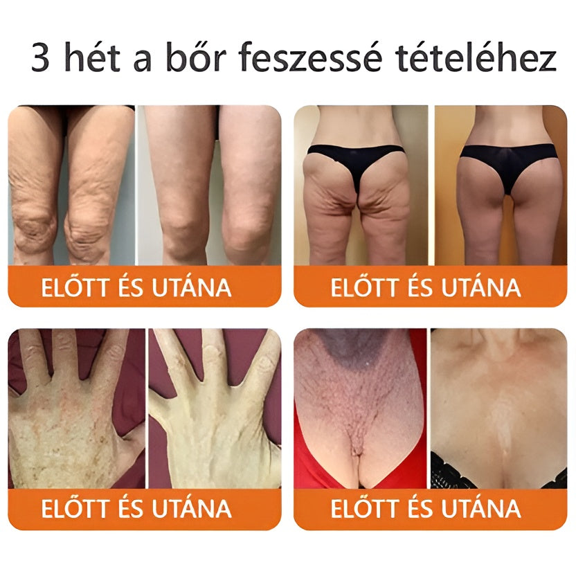 ZödVita® Méhméreg Bőr Helyreállító Krém 🔥 Magyar fejlesztés, magyarországi gyártás és szállítás