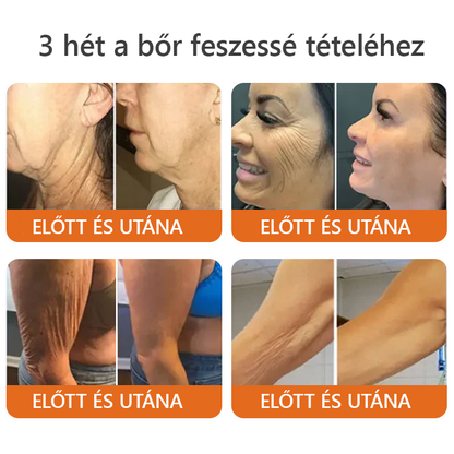 ZödVita® Méhméreg Bőr Helyreállító Krém 🔥 Magyar fejlesztés, magyarországi gyártás és szállítás
