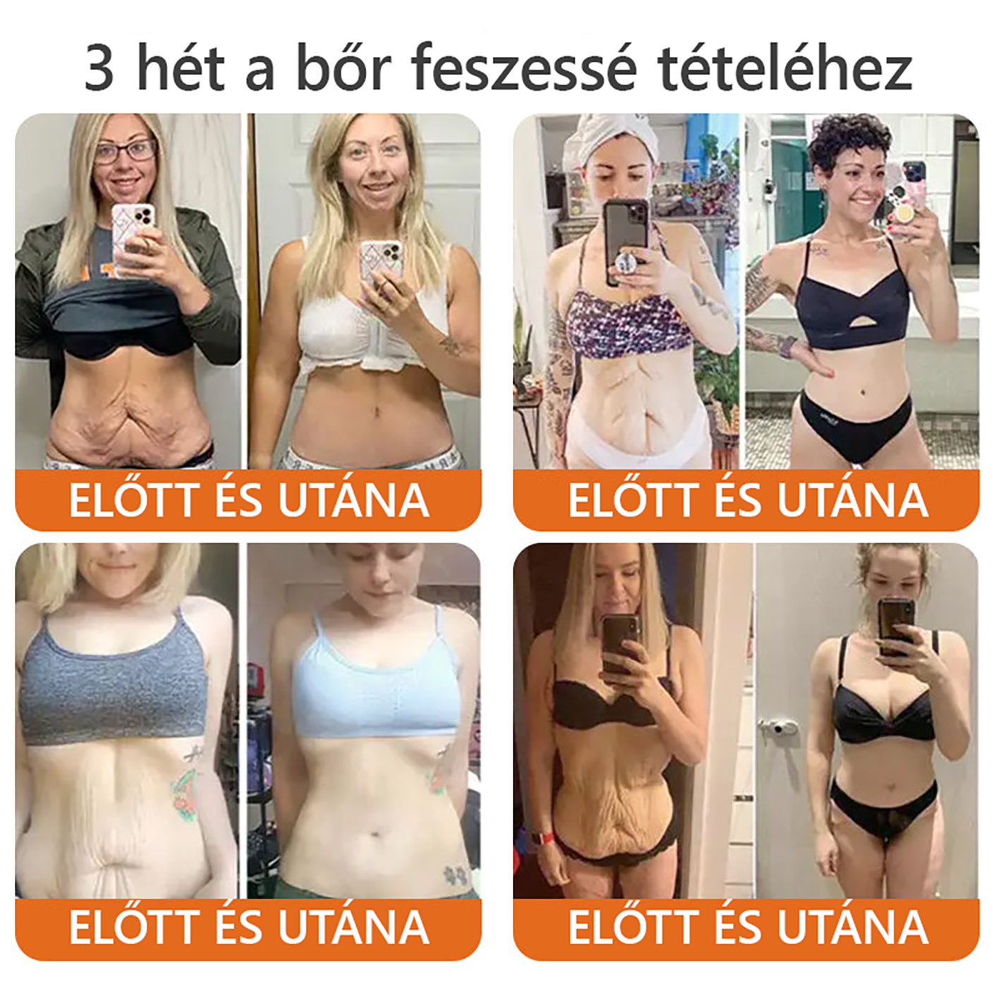 ZödVita® Méhméreg Bőr Helyreállító Krém 🔥 Magyar fejlesztés, magyarországi gyártás és szállítás
