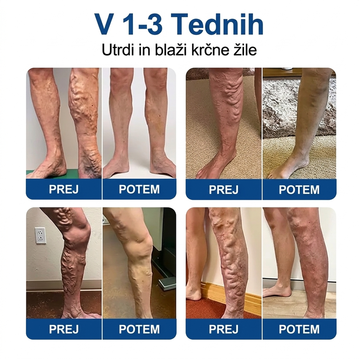 ✅ ✅✅Medistart® Visszérápoló Mikrotűs Gondozó Tapasz ⚡ Azonnali Megkönnyebbülés, Hosszú Távú Eredmények