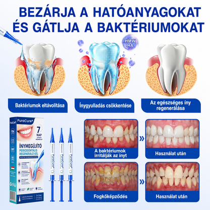 🇭🇺👨‍⚕️👨‍⚕️👨‍⚕️✅🦷 PuraCure® ÍNYMEGÚJÍTÓ – Parodontális helyreállító gél🧂