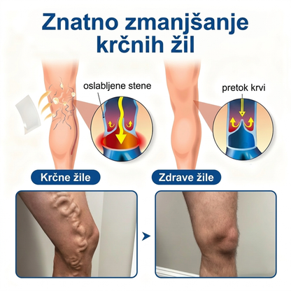 ✅ ✅✅Medistart® Visszérápoló Mikrotűs Gondozó Tapasz ⚡ Azonnali Megkönnyebbülés, Hosszú Távú Eredmények