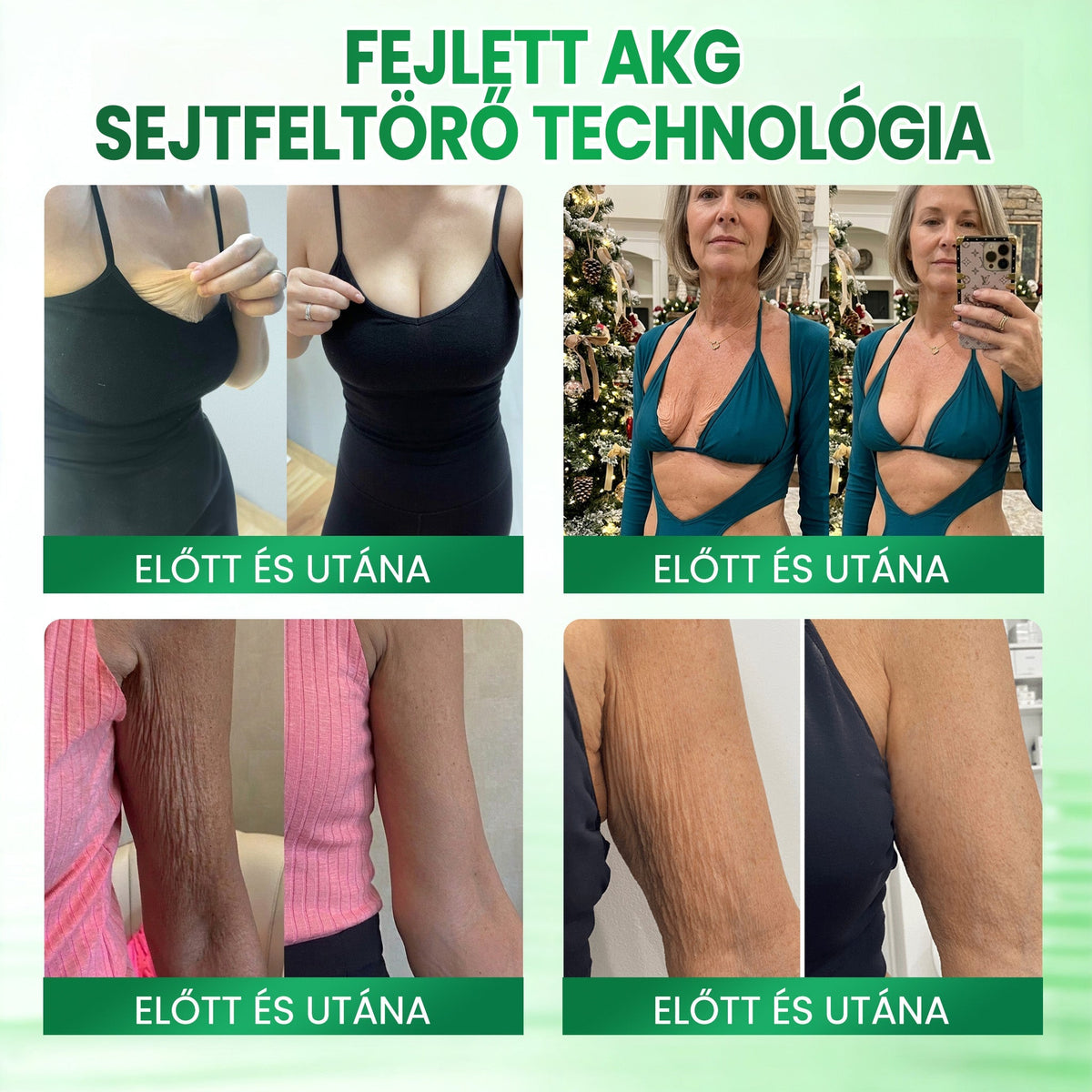 🔥🔥🔥Medistart® AKG BŐRFESZESÍTŐ & ÖREGEDÉS ELLENI ÁPOLÁS