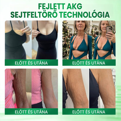 🔥🔥🔥Medistart® AKG BŐRFESZESÍTŐ & ÖREGEDÉS ELLENI ÁPOLÁS