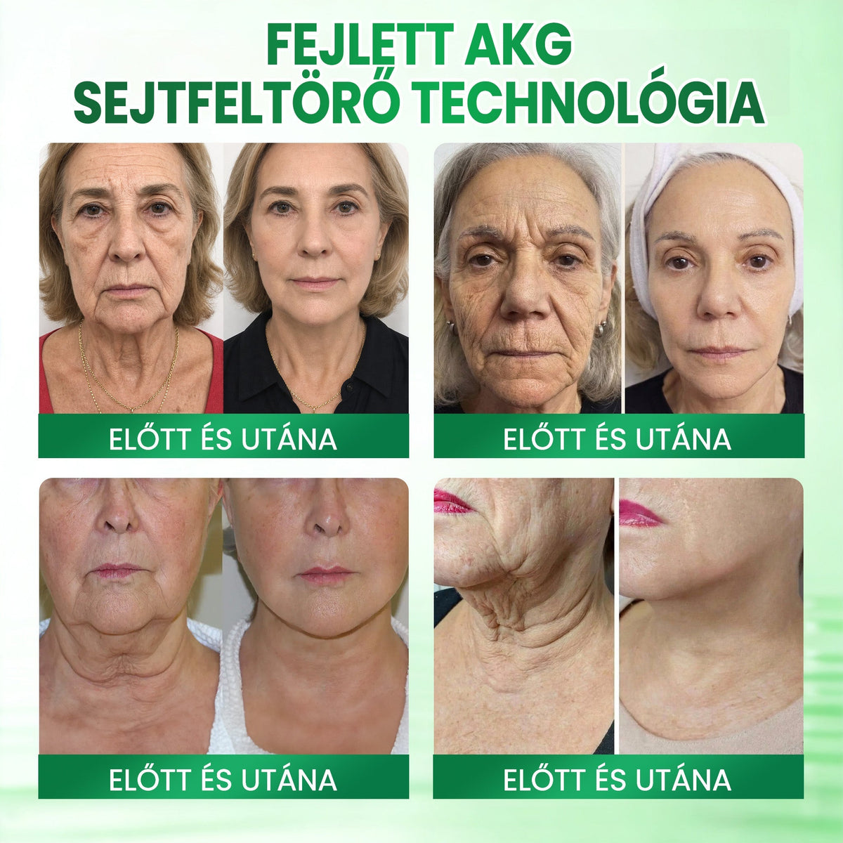 🔥🔥🔥Medistart® AKG BŐRFESZESÍTŐ & ÖREGEDÉS ELLENI ÁPOLÁS