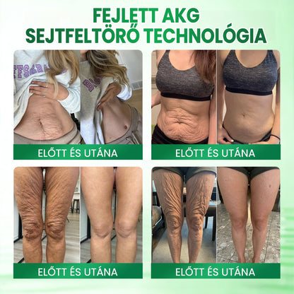 🔥🔥🔥Medistart® AKG BŐRFESZESÍTŐ & ÖREGEDÉS ELLENI ÁPOLÁS