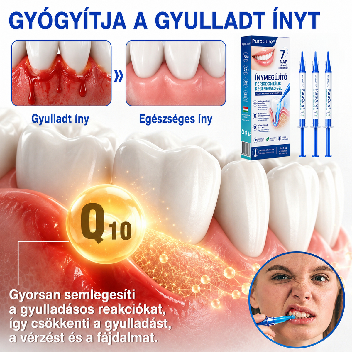 🇭🇺👨‍⚕️👨‍⚕️👨‍⚕️✅🦷 PuraCure® ÍNYMEGÚJÍTÓ – Parodontális helyreállító gél🧂