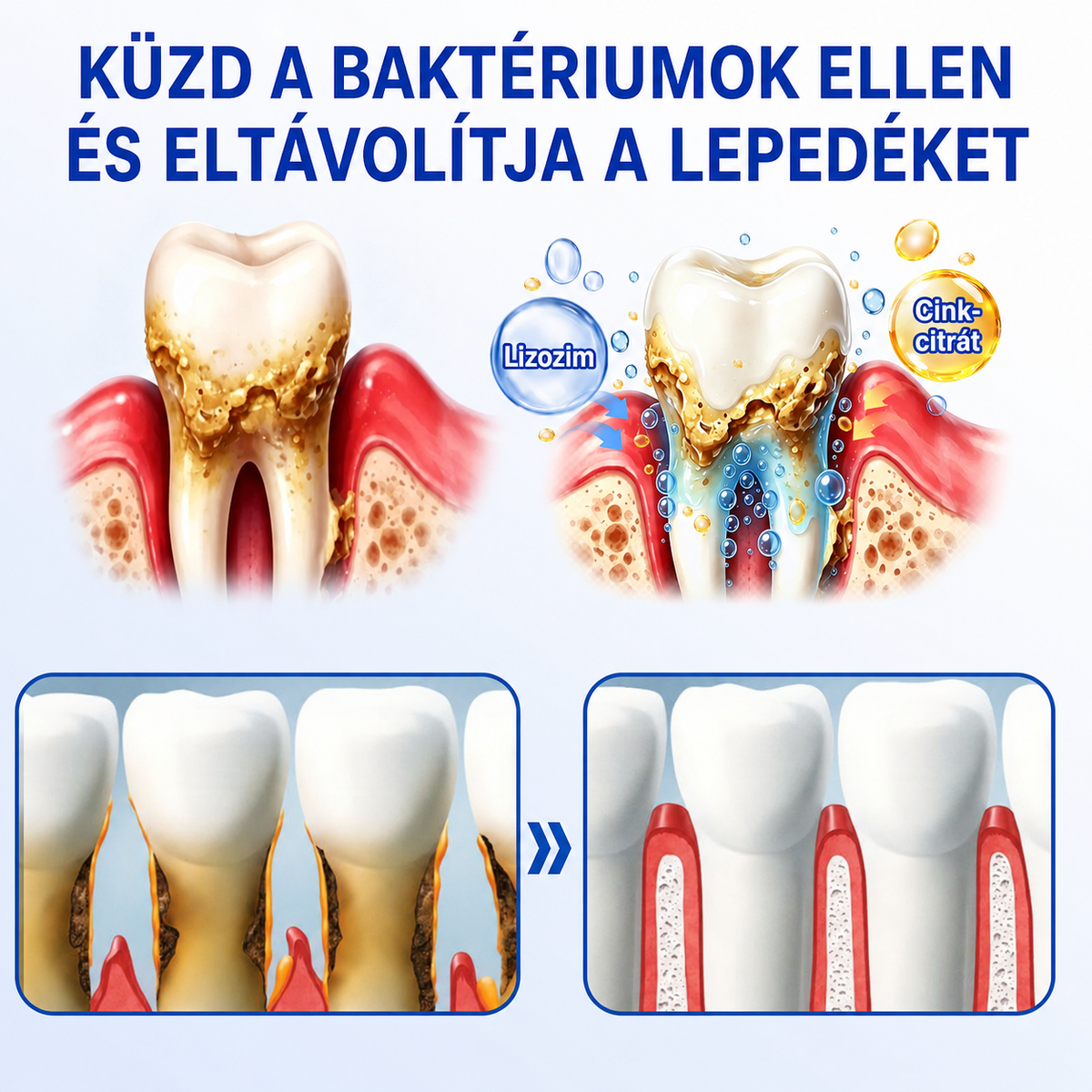 🇭🇺👨‍⚕️👨‍⚕️👨‍⚕️✅🦷 PuraCure® ÍNYMEGÚJÍTÓ – Parodontális helyreállító gél🧂