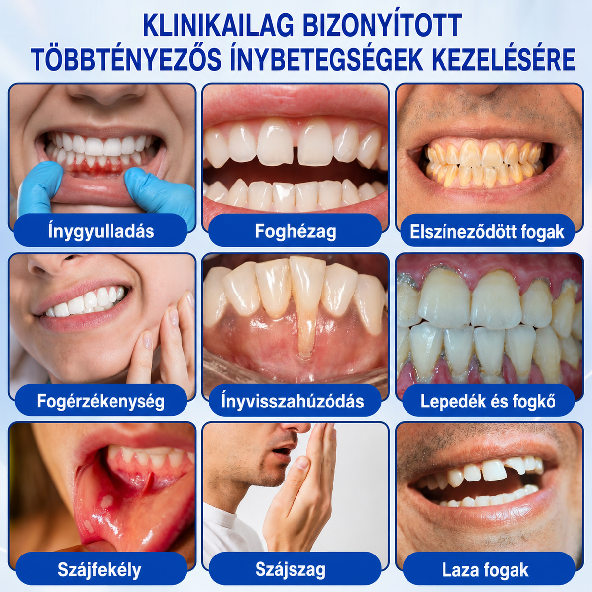 🇭🇺👨‍⚕️👨‍⚕️👨‍⚕️✅🦷 PuraCure® ÍNYMEGÚJÍTÓ – Parodontális helyreállító gél🧂