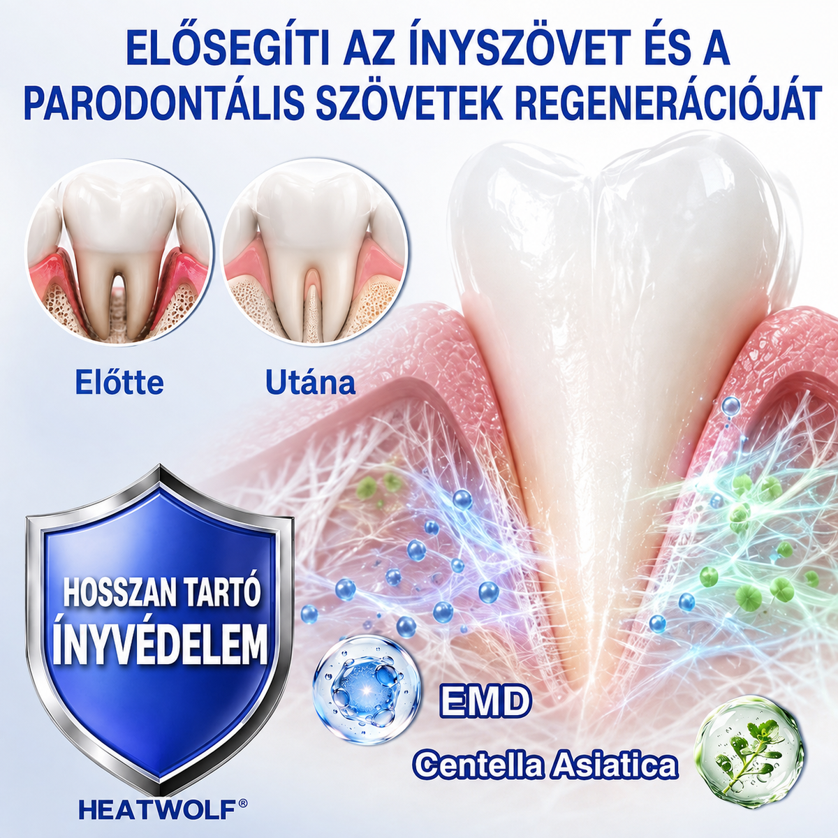 🇭🇺👨‍⚕️👨‍⚕️👨‍⚕️✅🦷 PuraCure® ÍNYMEGÚJÍTÓ – Parodontális helyreállító gél🧂