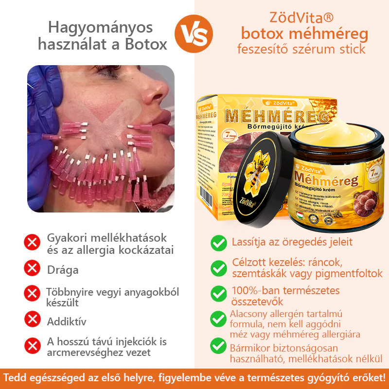 ZödVita® Méhméreg Bőr Helyreállító Krém 🔥 Magyar fejlesztés, magyarországi gyártás és szállítás