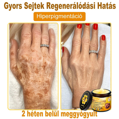 ZödVita® Méhméreg Bőr Helyreállító Krém 🔥 Magyar fejlesztés, magyarországi gyártás és szállítás