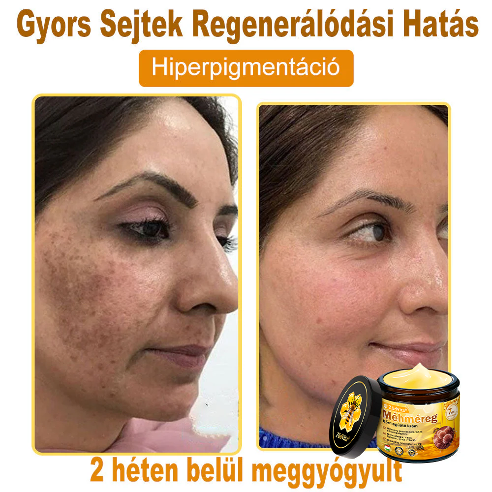 ZödVita® Méhméreg Bőr Helyreállító Krém 🔥 Magyar fejlesztés, magyarországi gyártás és szállítás